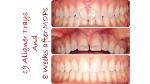 set-pcs-surgical-cqo